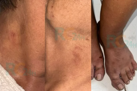 Idosa de 70 anos é estuprada nas proximidades da UPA em Cabo Frio