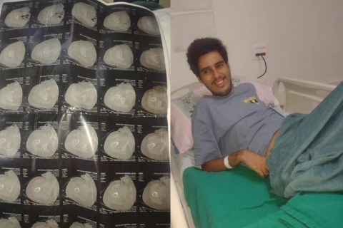 Família denuncia agressão a aluno autista em escola municipal de Cabo Frio; jovem está internado com fratura